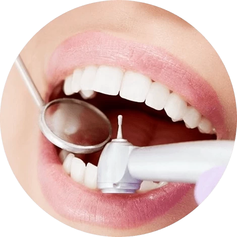 Баннер Лечение пришеечного кариеса Баннер Лечение пришеечного кариеса