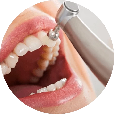 Баннер Ультразвуковая чистка зубов